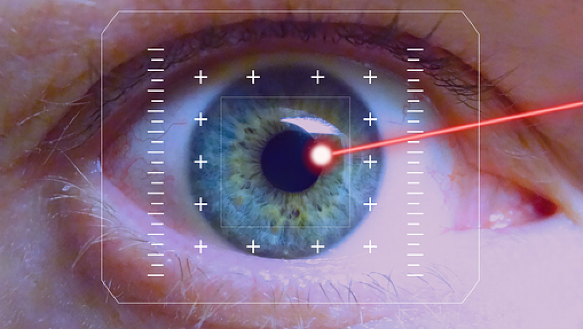 איזה טכנולוגיה יש לטיפול לייזר בעיניים?